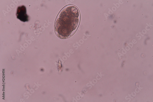 Hookworm egg under light microscopy