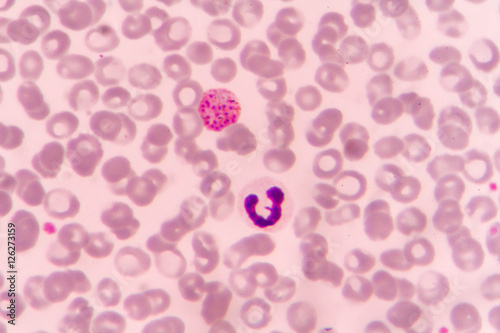 Malaria parasite P. vivax