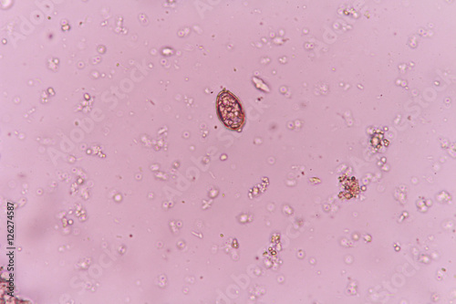 opisthorchis viverrini egg