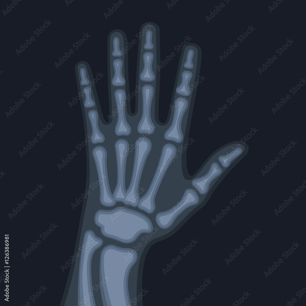 X Rays Style Human Hand. Vector X Rays Style Human Hand. Vector