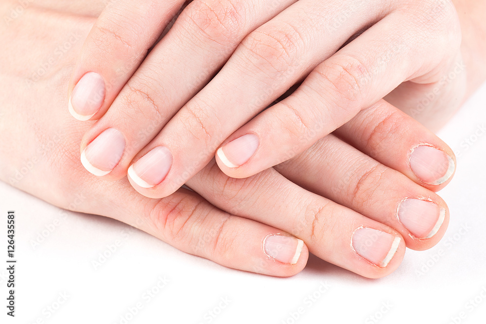 Comparison of the beautiful and the ugly manicure Comparison of the beautiful and the ugly manicure