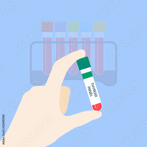 Medical tubing for thyroid panel test. Hand holding blood sample. Laboratory centrifuge tubing with green top. Medical equipment on blue background. Vector illustration.
