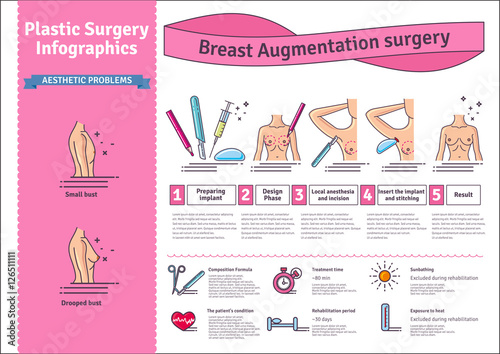 Vector Illustrated set with breast augmentation surgery