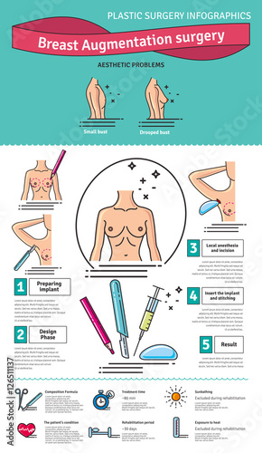 Vector Illustrated set with breast augmentation surgery