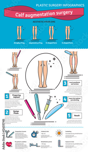Vector Illustrated set with calf augmentation surgery