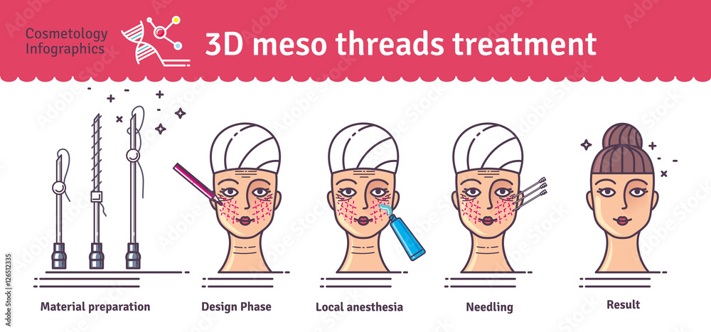Fototapeta premium Vector Illustrated set with 3d Meso Thread face Lift therapy
