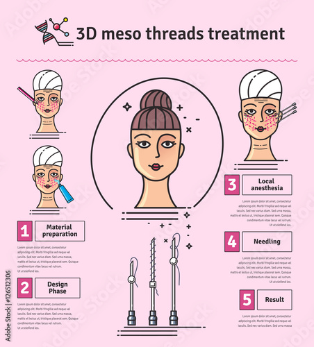 Vector Illustrated set with 3d Meso Thread face Lift therapy