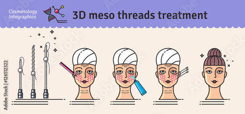 Vector Illustrated set with 3d Meso Thread face Lift therapy