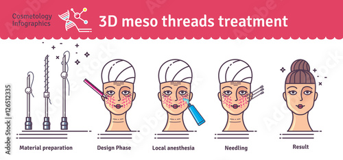 Vector Illustrated set with 3d Meso Thread face Lift therapy