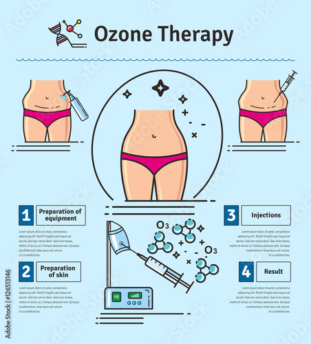 Vector Illustrated set with cosmetology ozone therapy