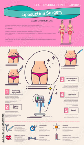 Vector Illustrated set with liposuction surgery