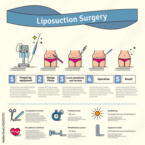 Vector Illustrated set with liposuction surgery