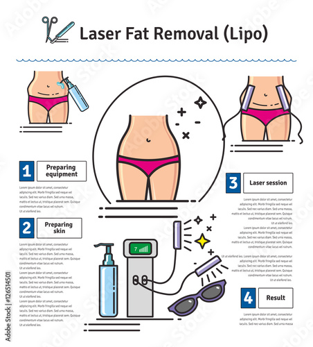 Vector Illustrated set with Laser LIPO Fat Removal