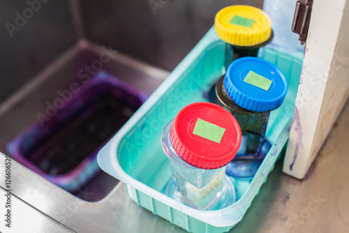 Wright stain for blood test in laboratory photo