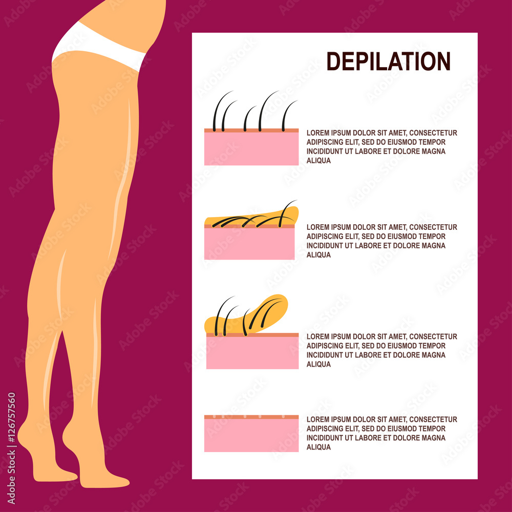 Depilation Vector illustration Slender female legs after waxing Scheme