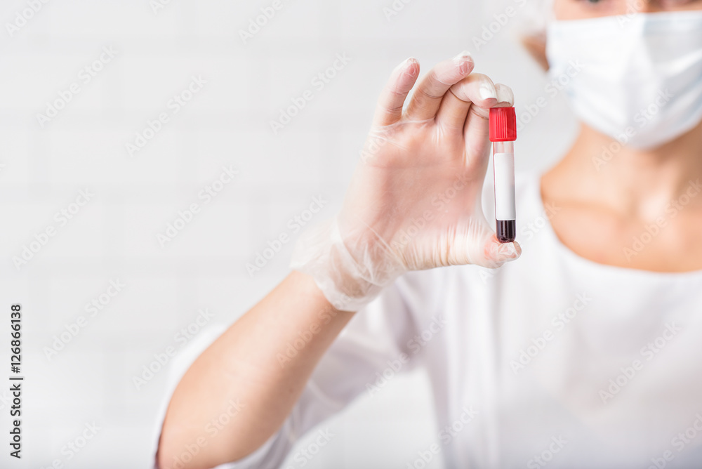 Skillful doctor holding blood sample Skillful doctor holding blood sample