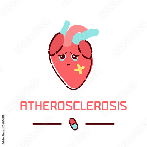 Atherosclerotic coronary artery vascular disease. Atherosclerosis awareness poster with cartoon heart on white background. Human body organs anatomy icon. Medical concept. Vector illustration.