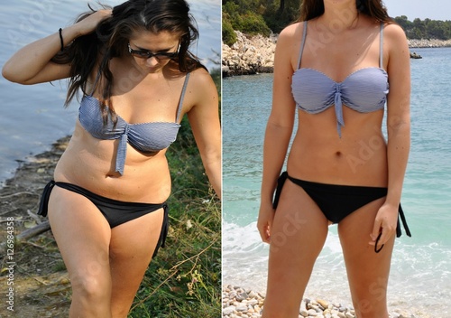 Real before and after weight loss photo of woman body in bikini photo