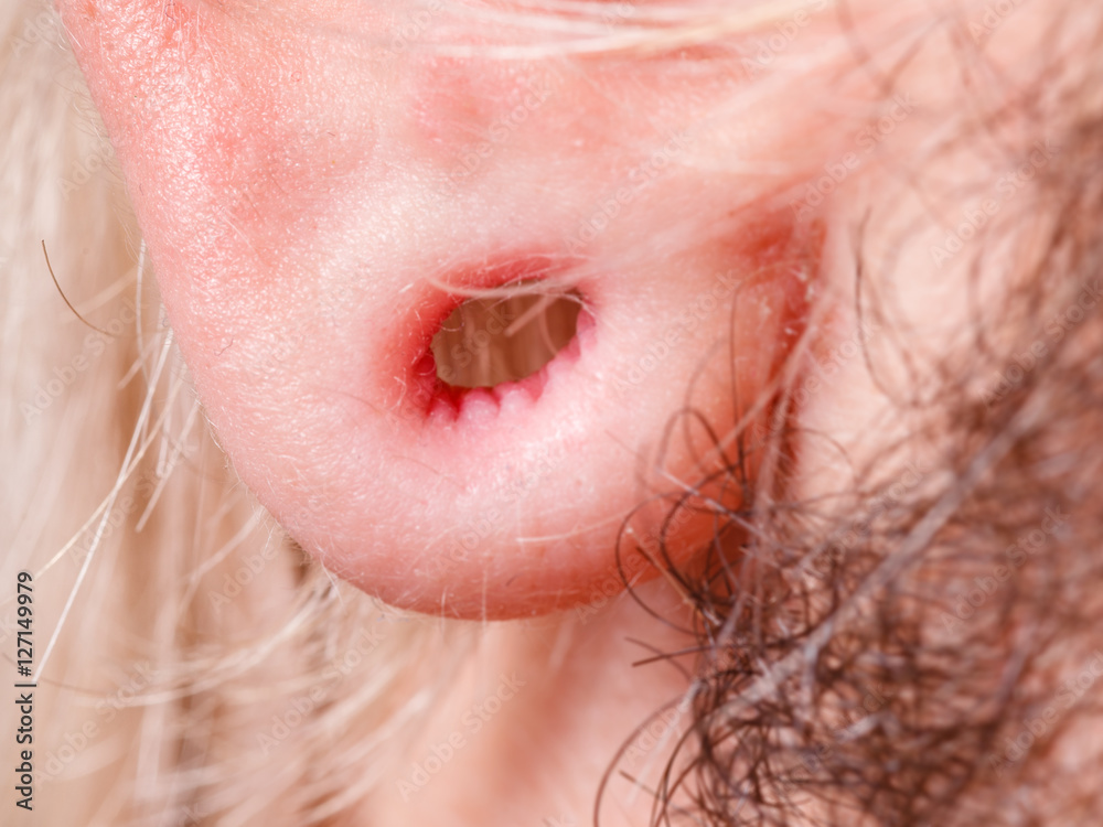 Fototapeta premium Stretched man ear after tunnel piercing