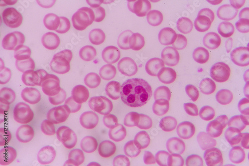 complete blood count