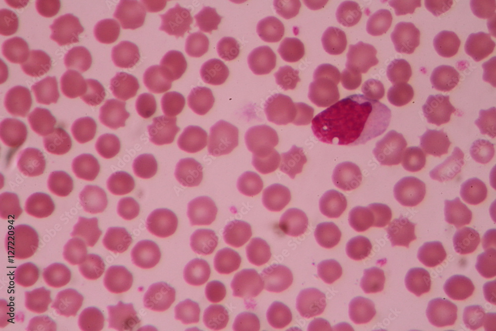 slide blood smear show white blood cell for complete blood count