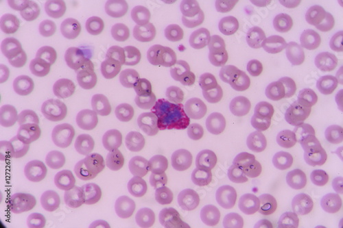 Basophil