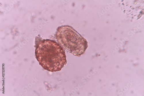 Paragonimus westermani and  Ascaris lumbricoides