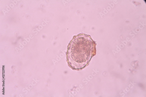 Ascaris lumbricoides
