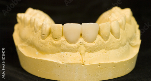 Calco denti photo