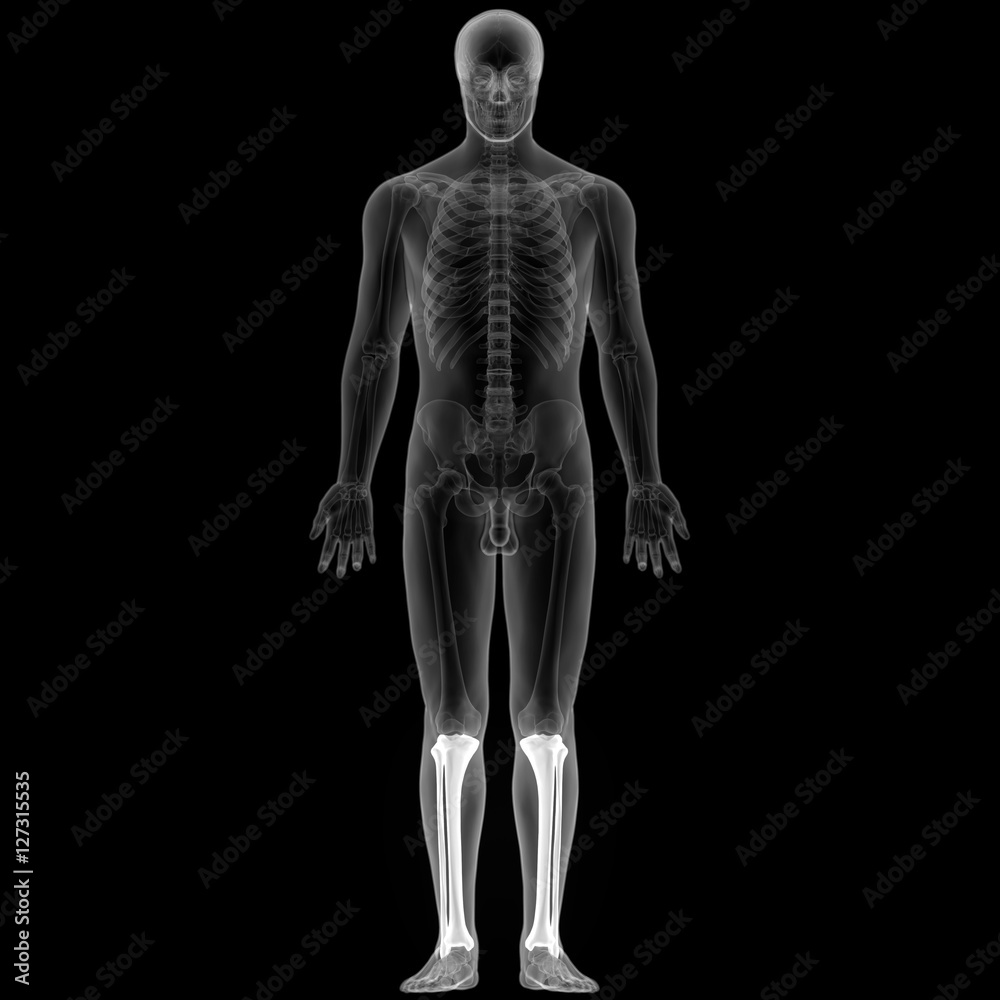 Human Body Bone Joint Pains (Tibia and Fibula joints) in xray scan
