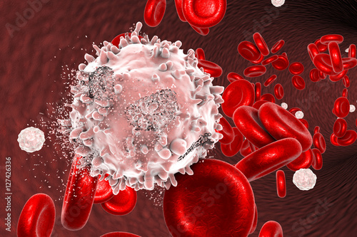 Destruction of leukaemia cell, conceptual image. 3D illustration which can be used to illustrate blood cancer treatment photo