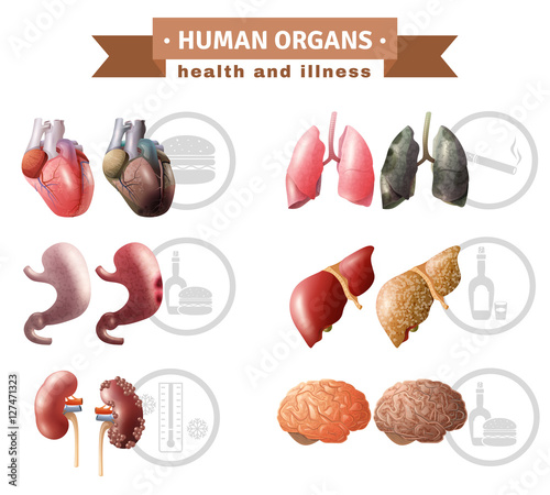 Human Organs Heath Risks Medical Poster