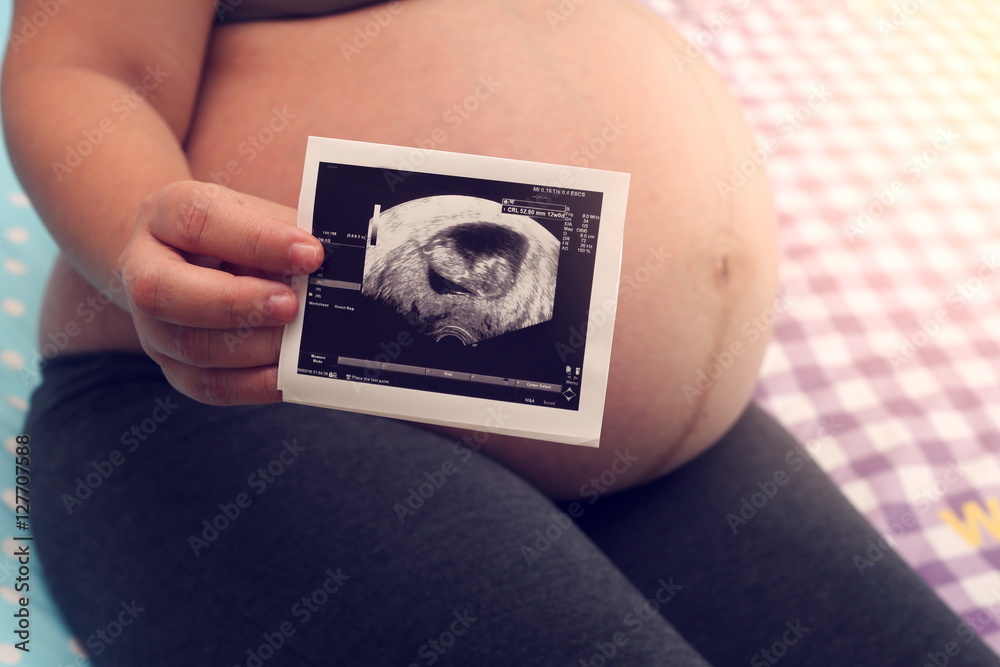 Pregnant woman hand holding ultrasound scan.Pregnant Asian woman close up shot Pregnant woman hand holding ultrasound scan.Pregnant Asian woman close up shot