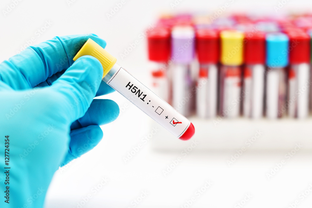 Fototapeta premium H5N1 influenza virus positive