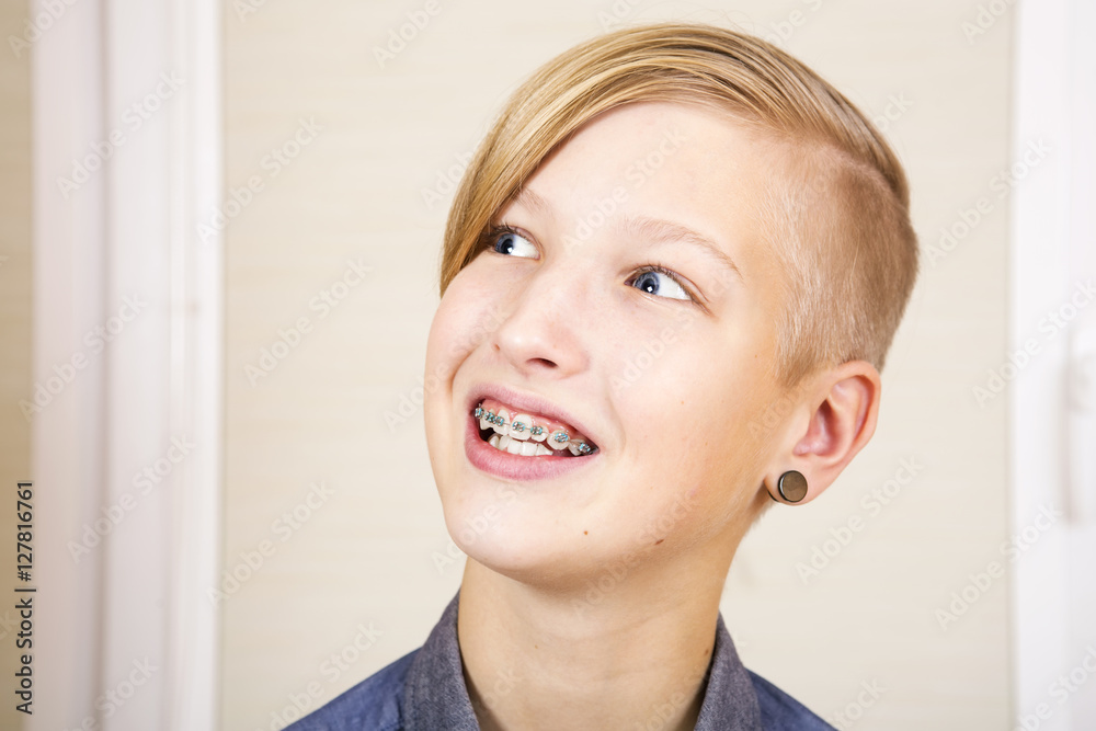 Teen with braces on his teeth and pierced ear. Orthodontics and bite correction. Teen with braces on his teeth and pierced ear. Orthodontics and bite correction.