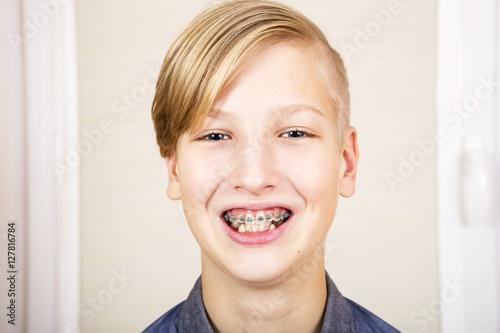 Teen with braces on his teeth. Orthodontics and bite correction.