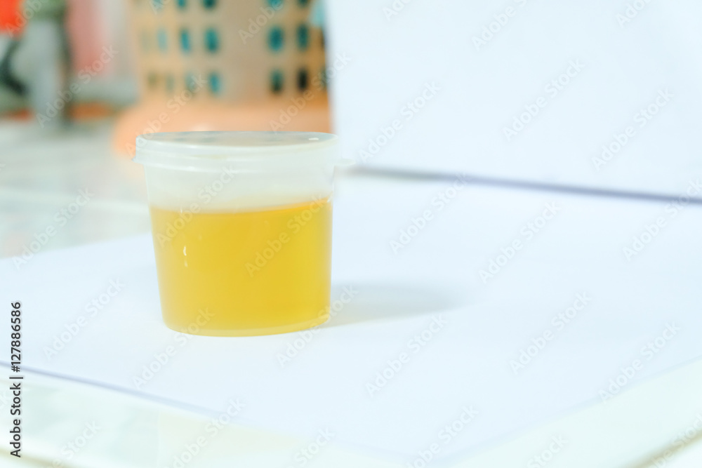 Urine sample for laboratory analysis Urine sample for laboratory analysis
