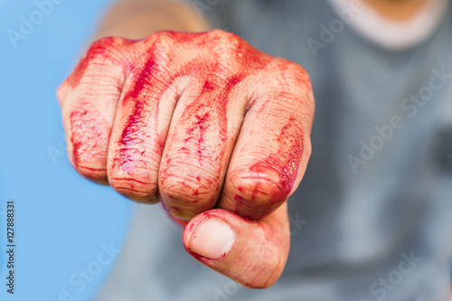 Obraz na plátne Bloody theme lone murderer: the murderer shows bloody hands and