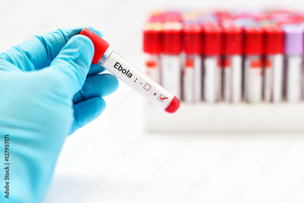 Obraz premium Ebola positive