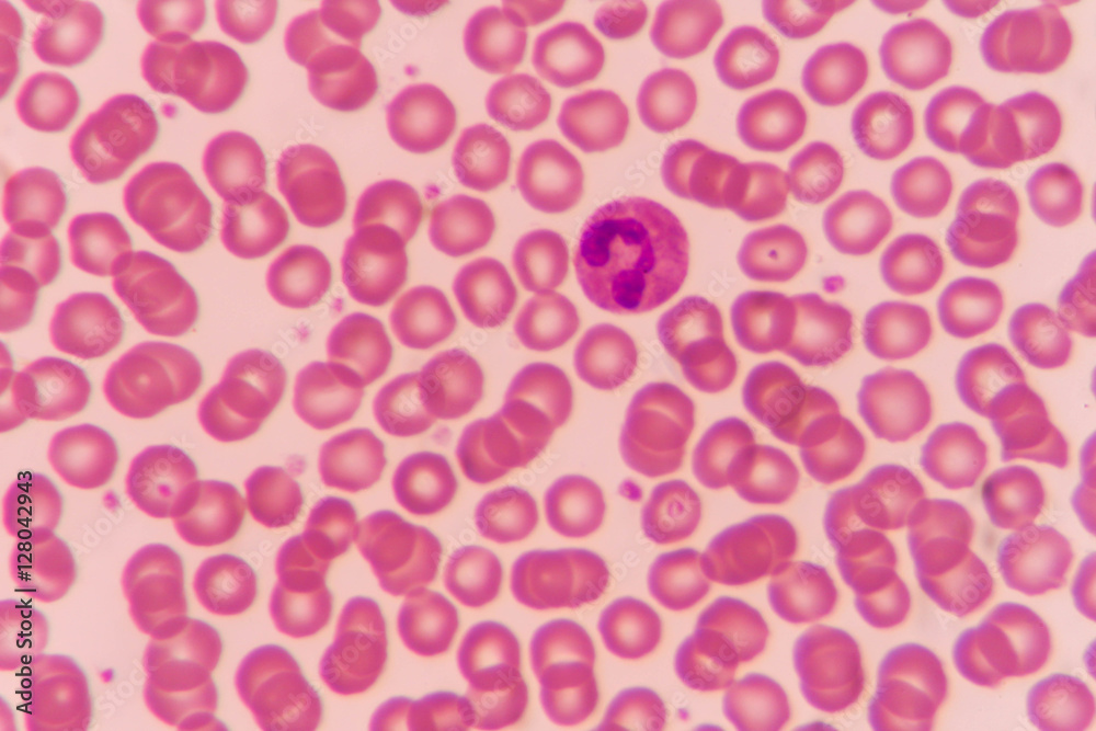 Normal red blood cells Under the microscope