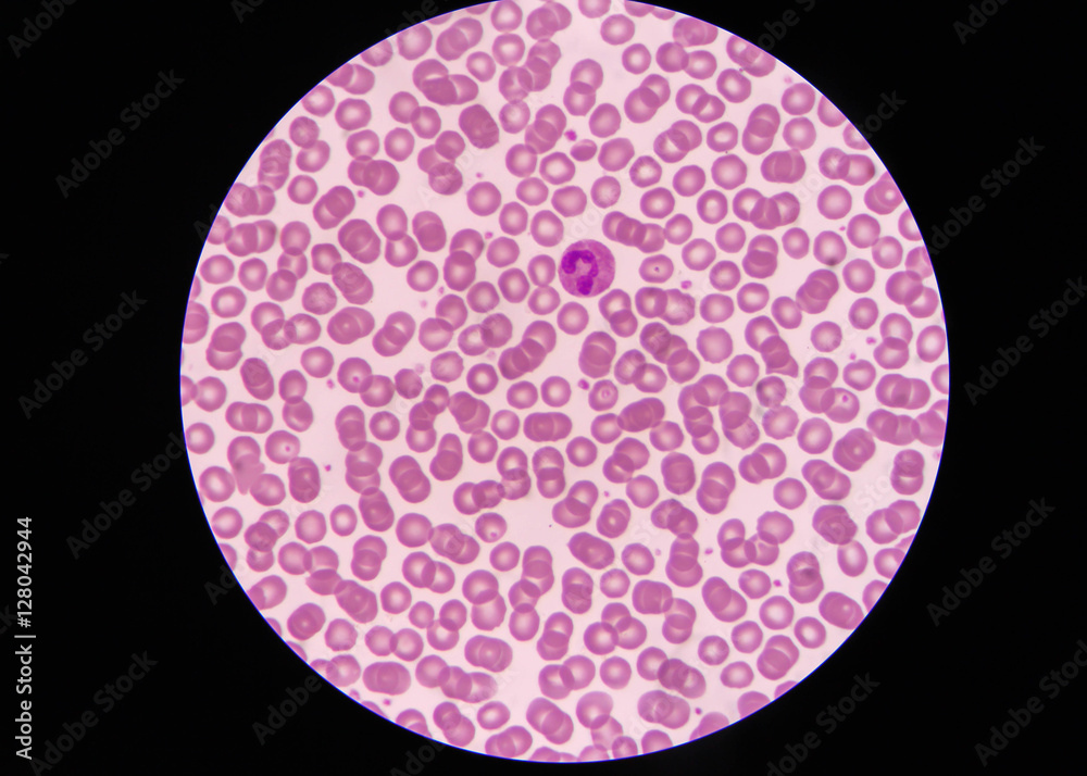 Normal red blood cells Under the microscope Stock Photo | Adobe Stock