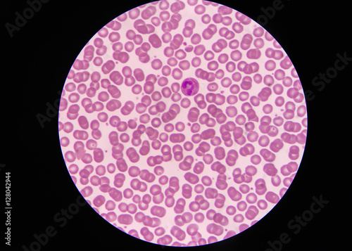 Normal red blood cells Under the microscope