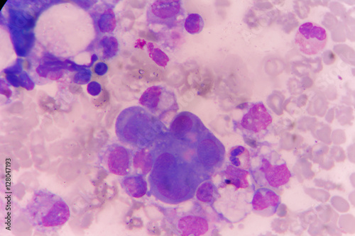 mesothelial cell