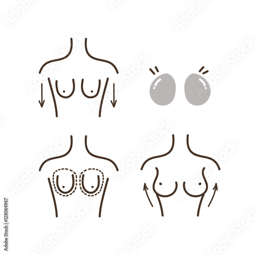breast implants