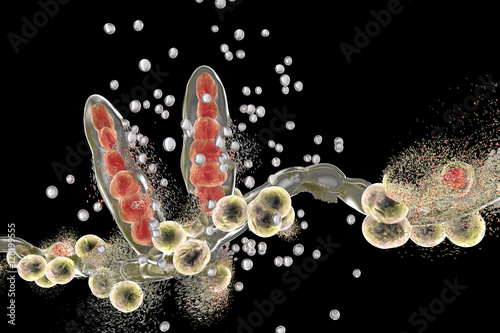 Destruction of fungus Trichophyton by silver nanoparticles, a fungus which causes athlete's foot Tinea pedis and scalp ringworm Tinea capitus. 3D illustration. Concept for antifungal treatment © Dr_Microbe