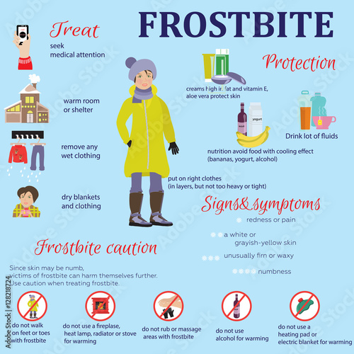 Frostbite - symptoms, protection and treatment. infographics photo