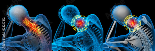 3d rendered illustration of pain neck x-ray collection