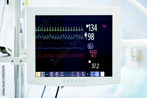 heart monitor during surgery