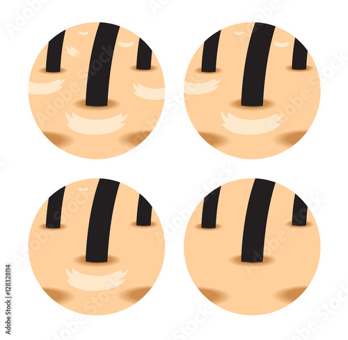 Dandruff stages vector , closeup on skin and dandruff ( black hair )