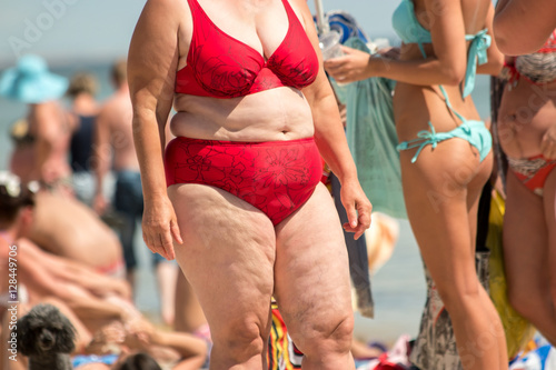 Obese woman in swimsuit. People on the beach. Sedentary lifestyle and poor nutrition. Risk of heart illnesses.